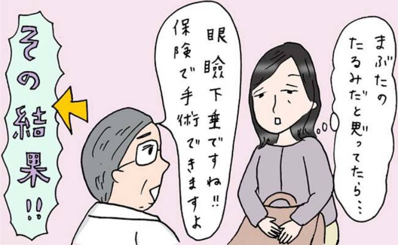 「まぶたがパンパンに腫れた」美容目的が想定外の眼瞼下垂。保険適用で手術した40代、術後のリアル