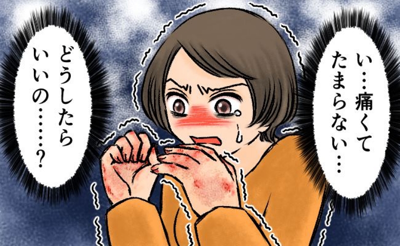 「痛くて洗い物すらできない」結婚・出産で突如手の甲がひび割れ！病院で診断された病名は