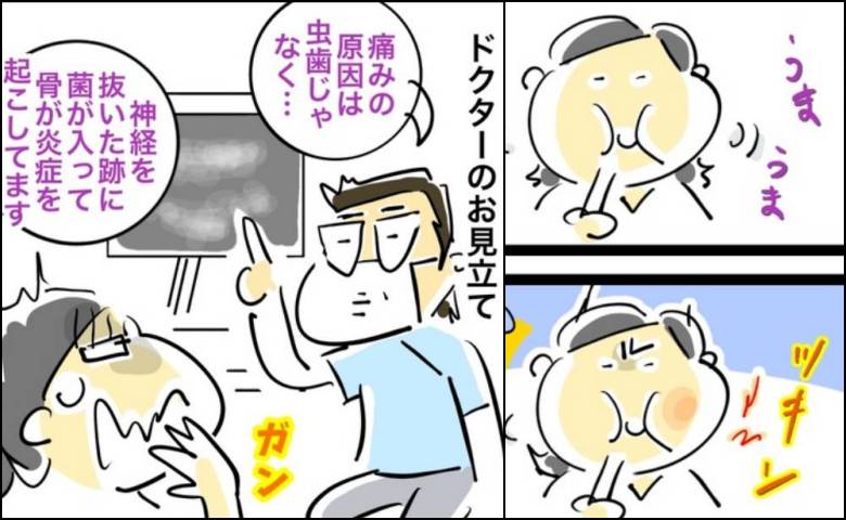 「最悪の場合は抜歯になる」医師の言葉。根本治療を避けて薬を選択したワケ #銀歯の下の悲劇 1