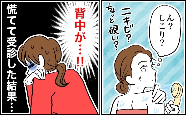 「しこりが破裂寸前！？」外出中に背中がズキズキ…病院へ駆け込み処置を受けた結果【体験談】