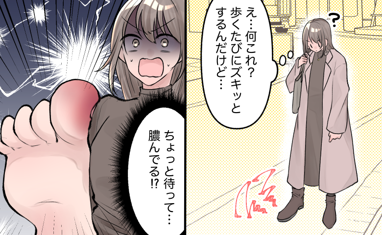 「膿が…」食い込む爪と化膿した足指の激痛！ようやくわかった痛みの理由とは【体験談】