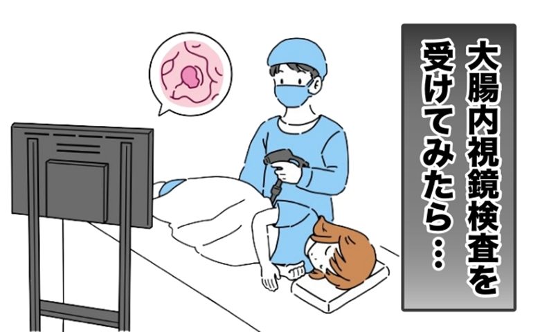 「父が大腸がんだから」念のため受けた内視鏡検査。自覚症状ゼロの私が医師から告げられた思わぬ診断名