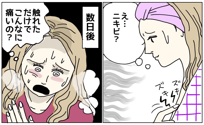 「ニキビかな…」胸の横にできた小さな膨らみを放置した結果、医師から告げられた病名とは【体験談】