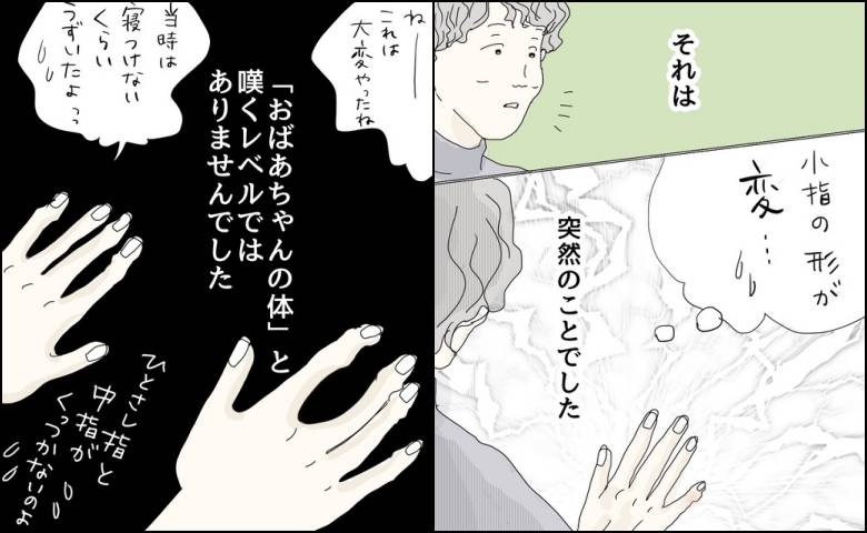 「おばあちゃんの体みたい」小指の突然の変形に気付いた私。ママ友の両手を見た瞬間 #五十路日和 99