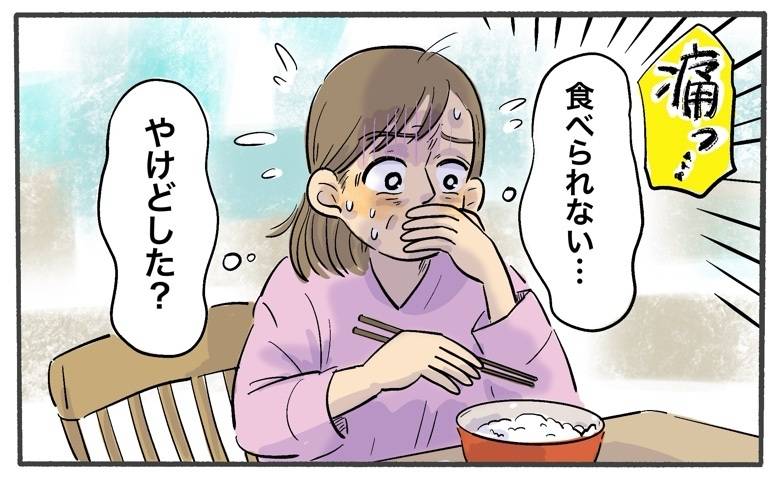 「痛くて食べられない」やけどと思っていた口の痛み。受診でわかった意外な原因は【医師監修】