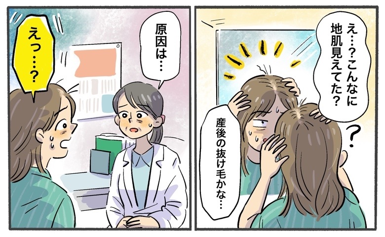 「産後の抜け毛かな」と思っていた不調…薄毛をきっかけに判明した思わぬ病気【医師解説あり】