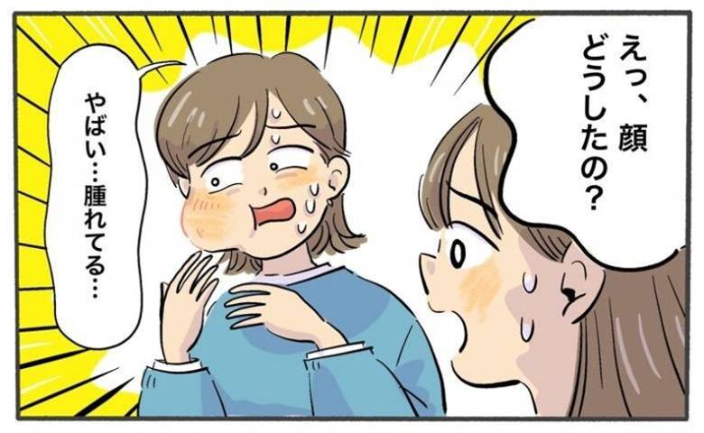 「また腫れてる」食事のたび顔がパンパンに。外食が怖くなった理由【医師監修】