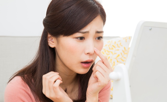 目立ってきた両頬のシミ 美容皮膚科のレーザー治療でシミ取り 体験談 ベビーカレンダーのベビーニュース