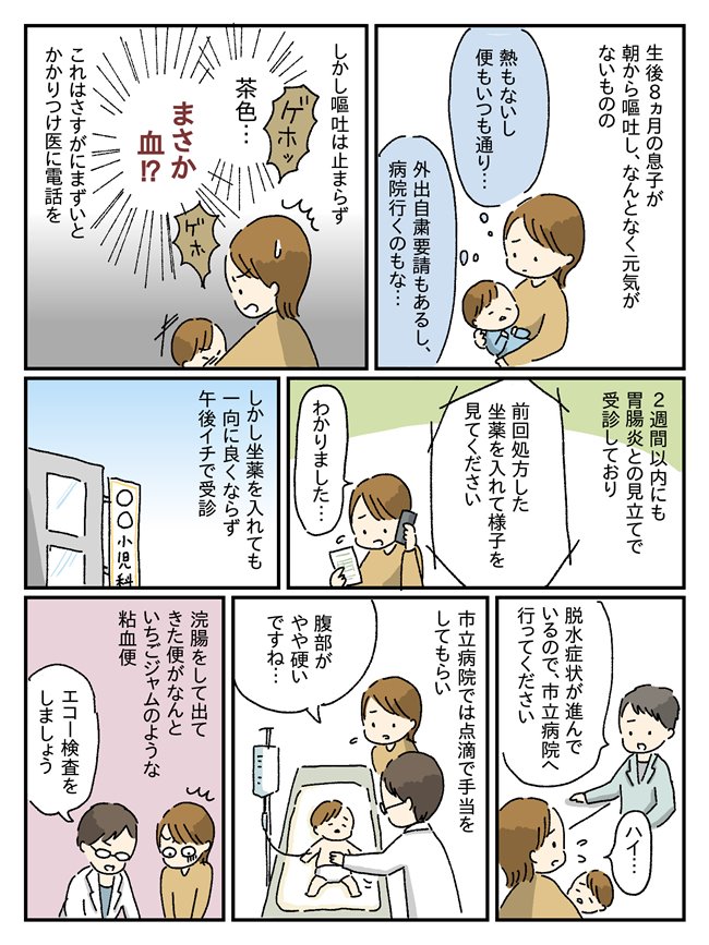 生後8か月、嘔吐が止まらず…検査の件おなかの中で小腸が大変なことに