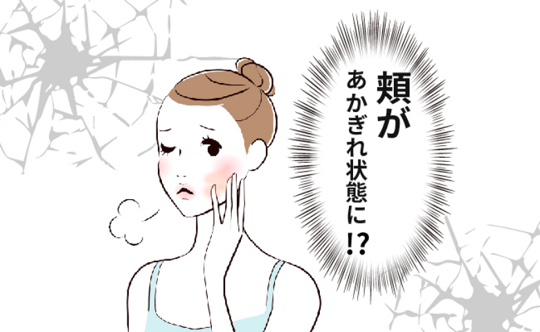 「肌がカピカピ」乾燥であかぎれ状態。赤ちゃん時代の息子の使い残しを見てドラッグストアに走ったワケ