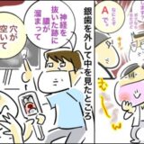 医師「膿がたまり穴が」銀歯の下の状態に絶句。私が突きつけられた究極の二択 #銀歯の下の悲劇 2