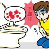 激しい腹痛と発熱、さらに下血まで…内科でおなかの風邪と診断されるも回復せず胃腸科で診断されたのは