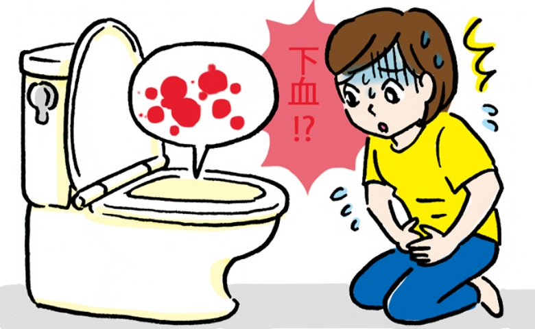 激しい腹痛と発熱、さらに下血まで…内科でおなかの風邪と診断されるも回復せず胃腸科で診断されたのは
