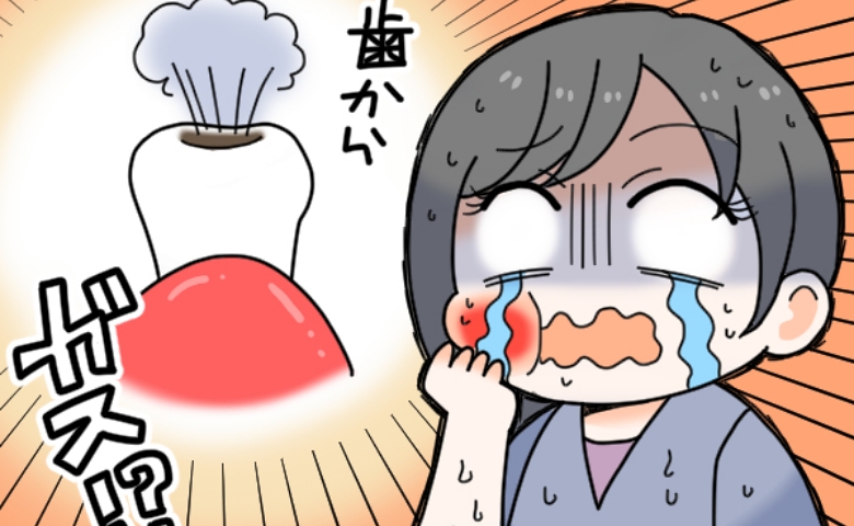 「虫歯からガスが発生！？」突然、襲ってきた強烈な虫歯の痛み。虫歯を放置した結果、大変なことに！