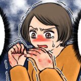 手の甲が割れ、痛くてたまらない！ なかなか治らないひどい手荒れ、皮膚科で診断されたのは【体験談】