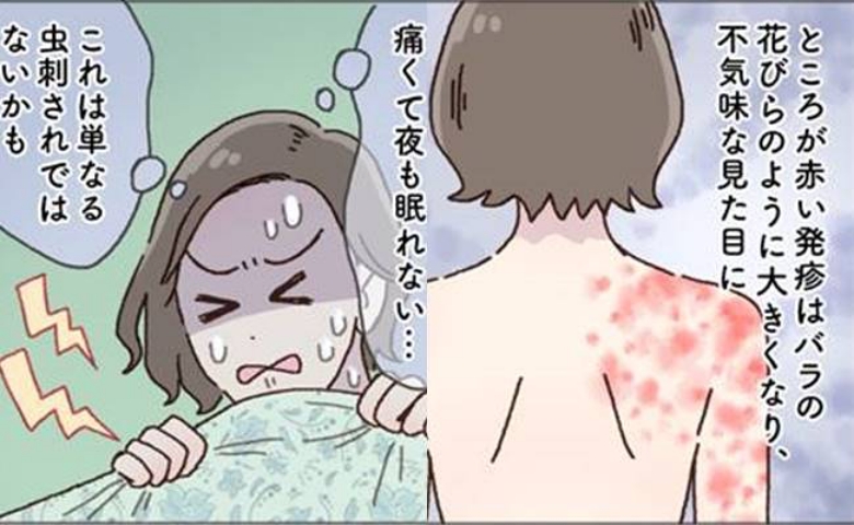 突然、肩に痛み、赤い発疹が広がり…免疫力の低下から思わぬ病気を発症！【体験談】