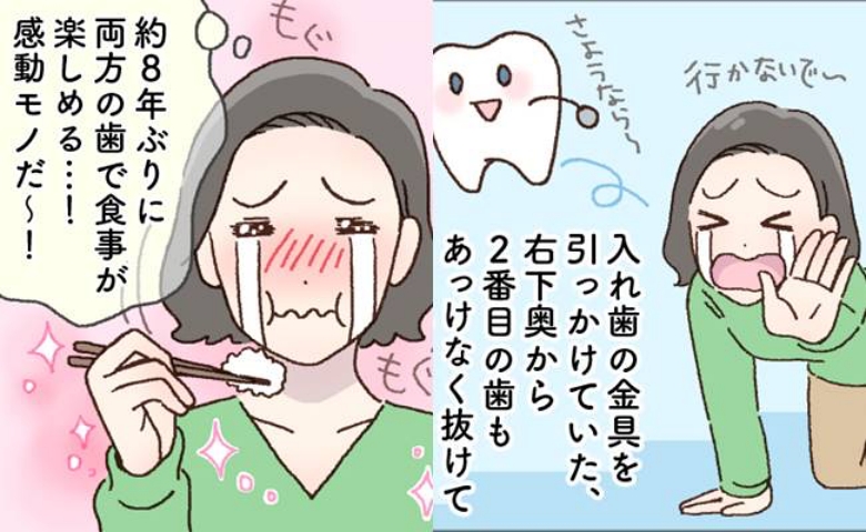 悲劇の連続…40代半ばまでに歯を4本失った！ 200万円をかけて歯を治療した結果は【体験談】