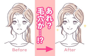 「あれ？ 毛穴が…！？」プチプラのクレンジングクリームを2カ月間使い続けた結果【体験談】