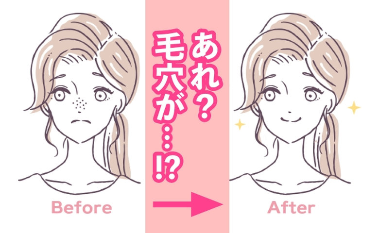 「あれ？ 毛穴が…！？」プチプラのクレンジングクリームを2カ月間使い続けた結果【体験談】