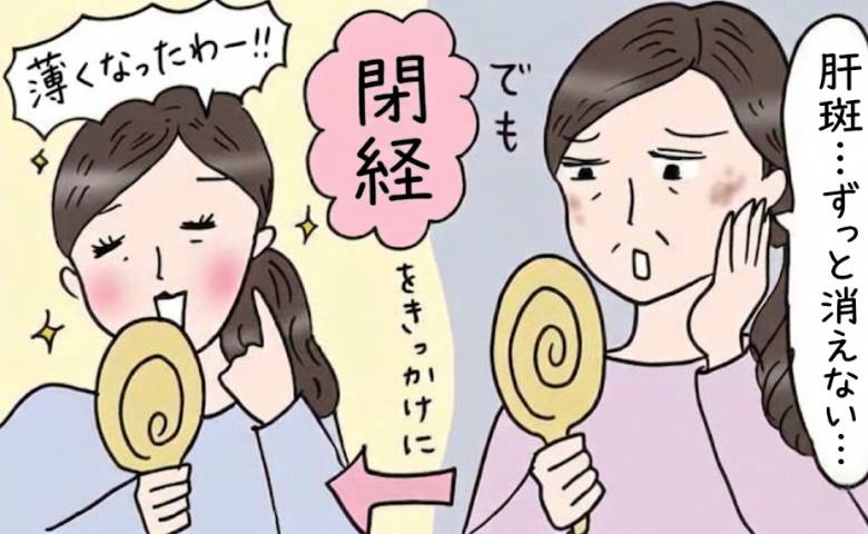 肝斑が薄くなった女性