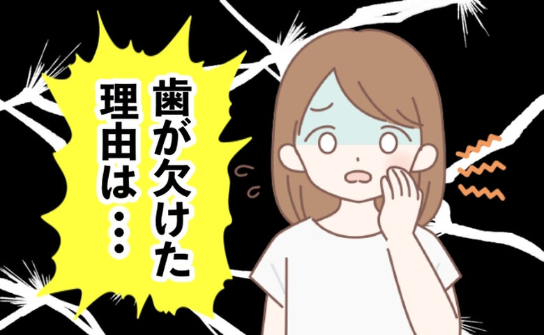 歯が欠けた女性のイメージ