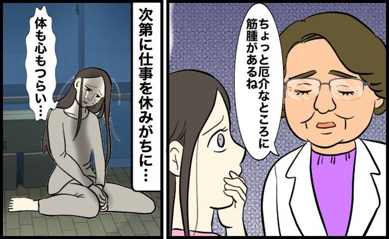 子宮筋腫ができてつらい女性