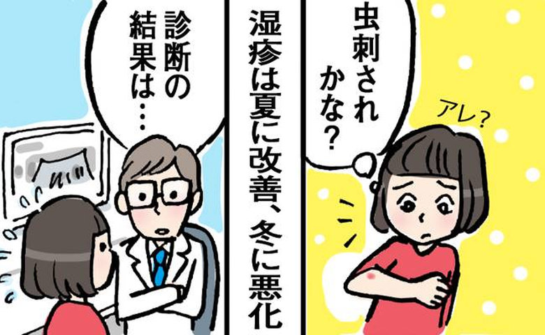 季節性の湿疹に悩む女性のイメージ