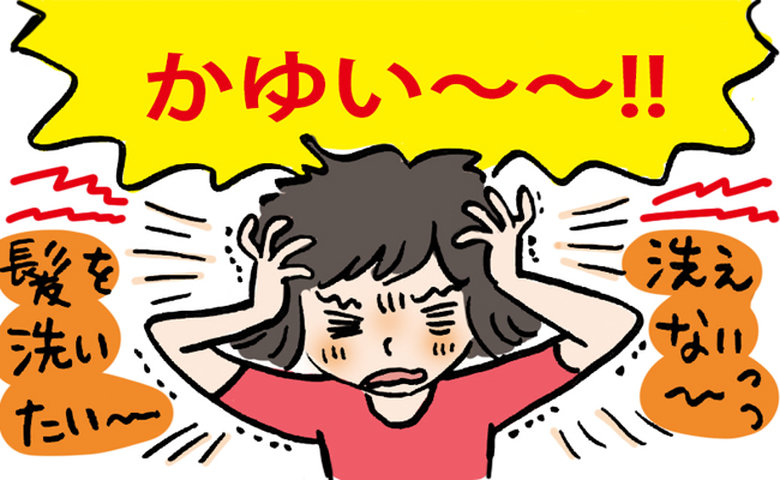 頭皮のかゆみを感じる女性のイメージ