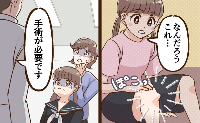 見たことのない出っ張りと、医師からの言葉に驚く女性のイメージ