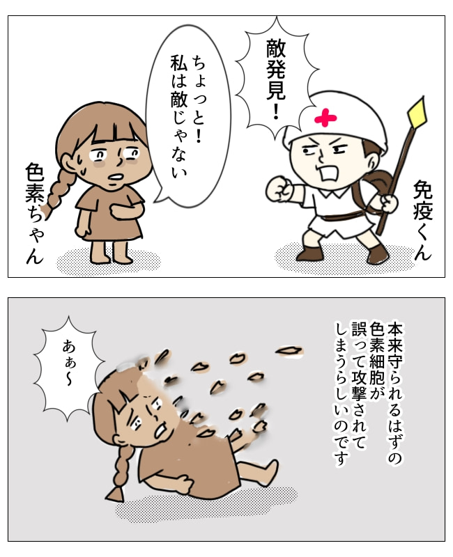 娘の尋常性白斑／フワリー
