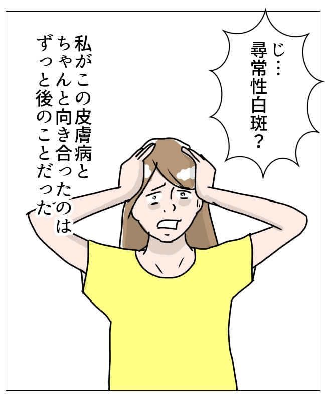 娘の尋常性白斑／フワリー