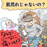 産後の私を襲った突然の激痛「肌荒れだと思っていたら…」受診した結果、まさかの病気が判明
