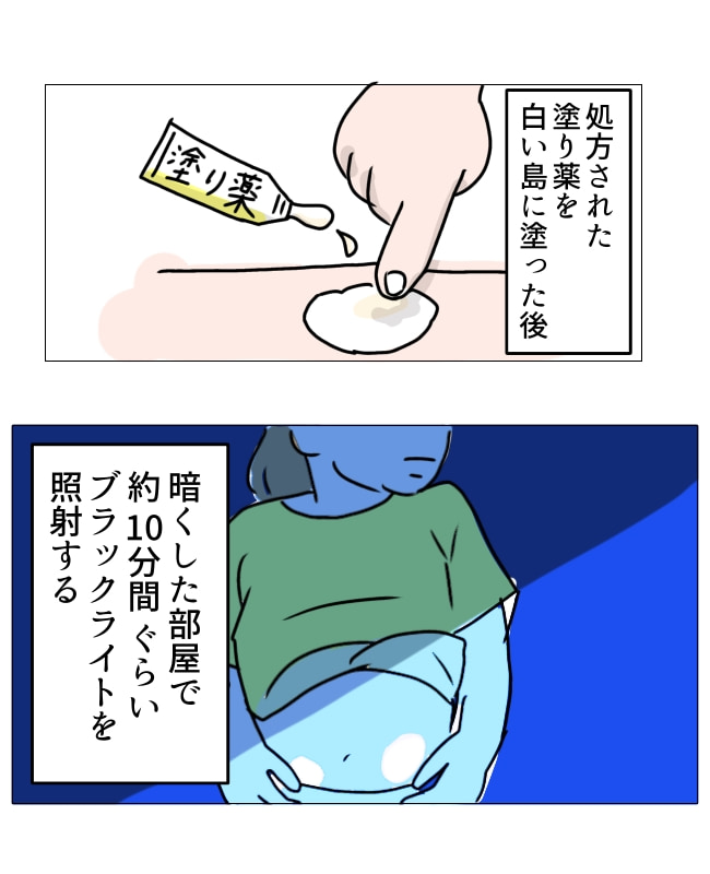 娘の尋常性白斑／フワリー