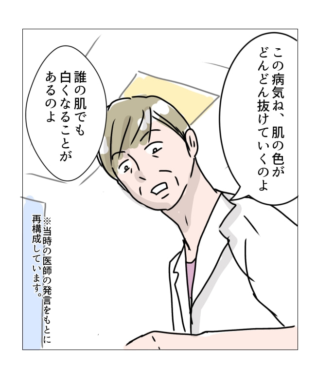 娘の尋常性白斑／フワリー