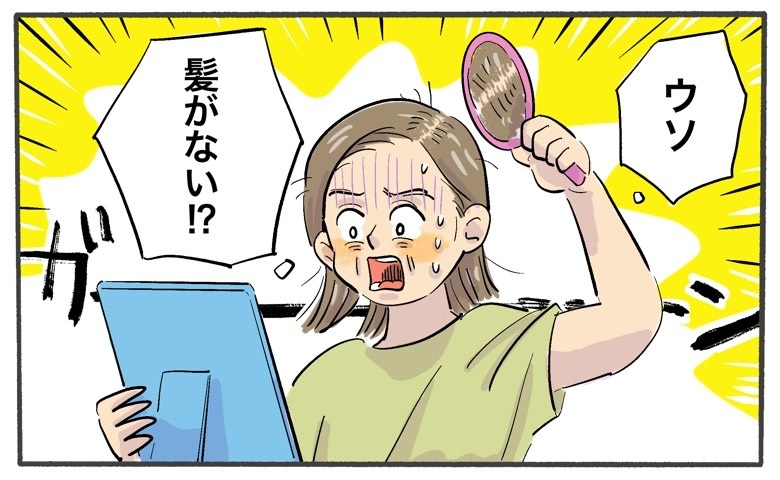 「頭頂部に髪がない！？」40歳から気になり始めた薄毛…対処法は【体験談】