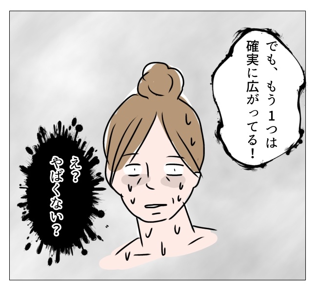 娘の尋常性白斑／フワリー
