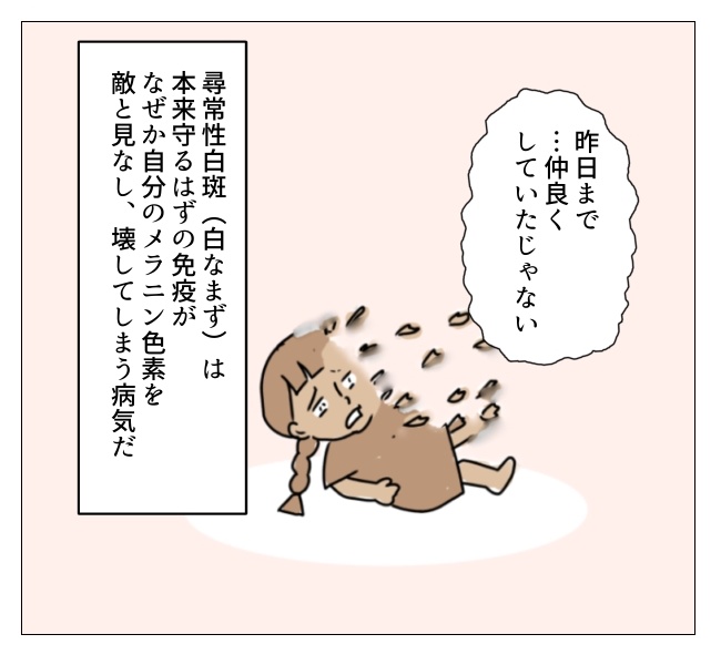 娘の尋常性白斑／フワリー