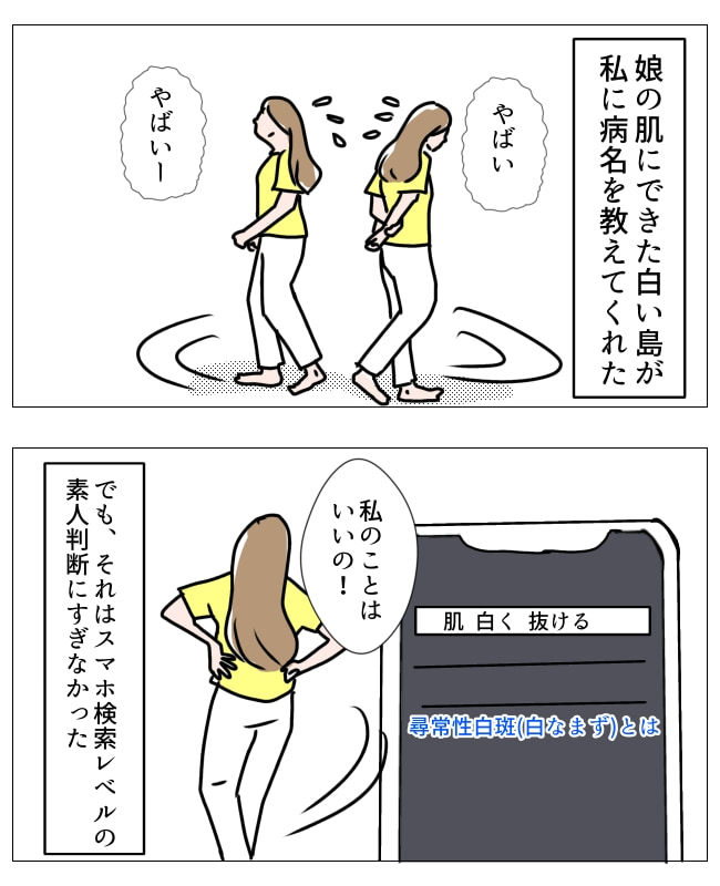娘の尋常性白斑／フワリー