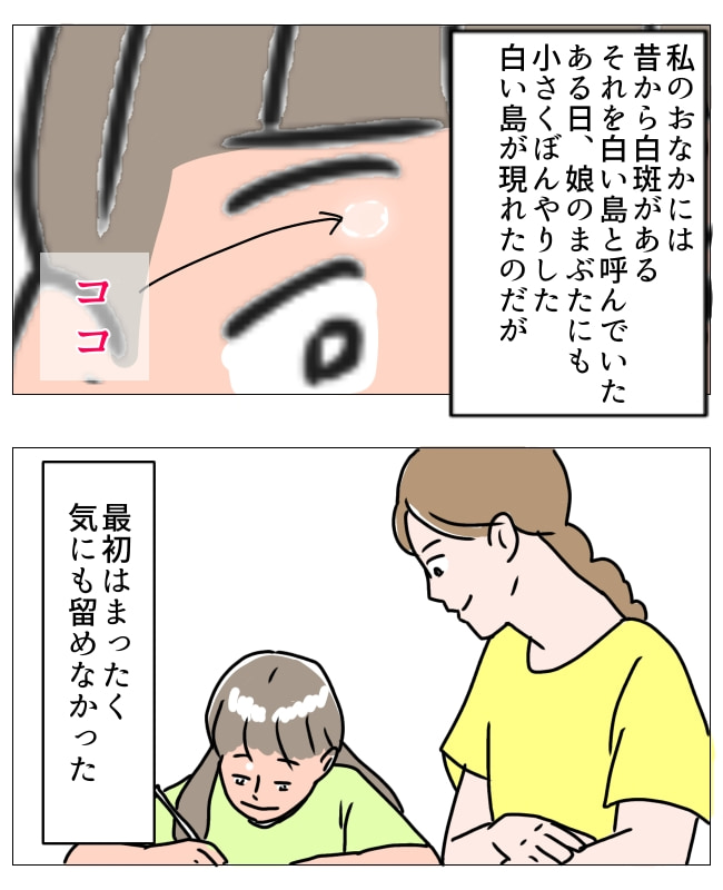 娘の尋常性白斑／フワリー