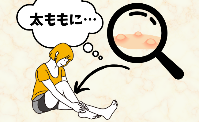 思わぬ病気・症状　イメージイラスト