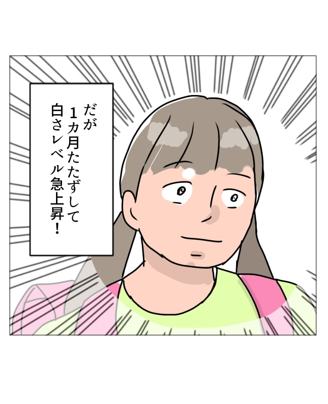 娘の尋常性白斑／フワリー