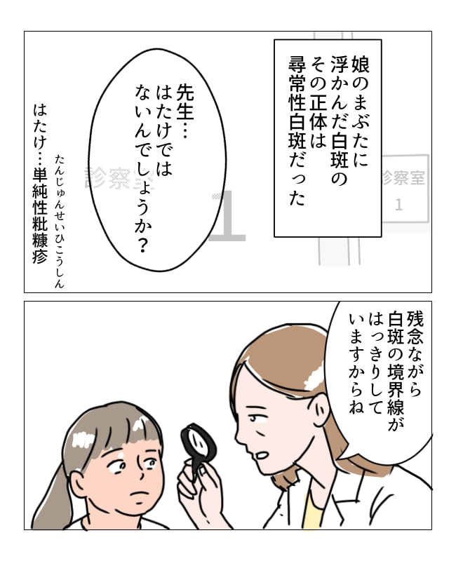 娘の尋常性白斑／フワリー