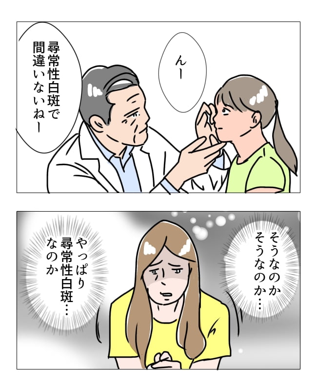 娘の尋常性白斑／フワリー