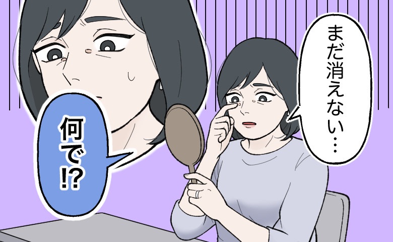 「目頭にできた謎の膨らみ」花粉症から来る肌トラブルと思いきや…意外な病気につながった話【体験談】