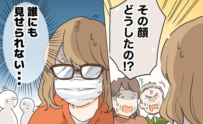 肌のトラブルに悩む女性