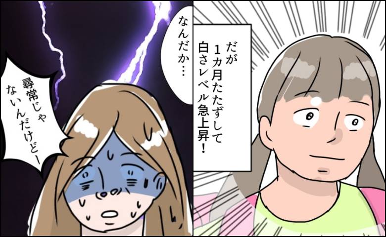 娘の尋常性白斑／フワリー