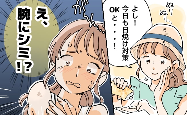 シミに悩む女性