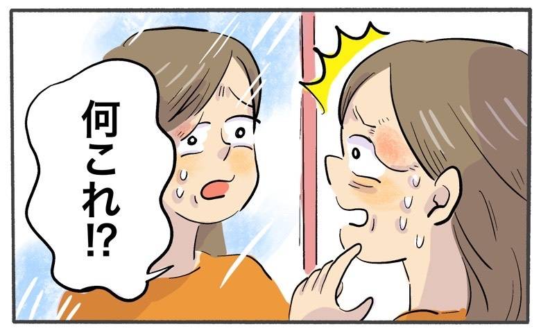 目のそばに大きな謎の腫れができた女性