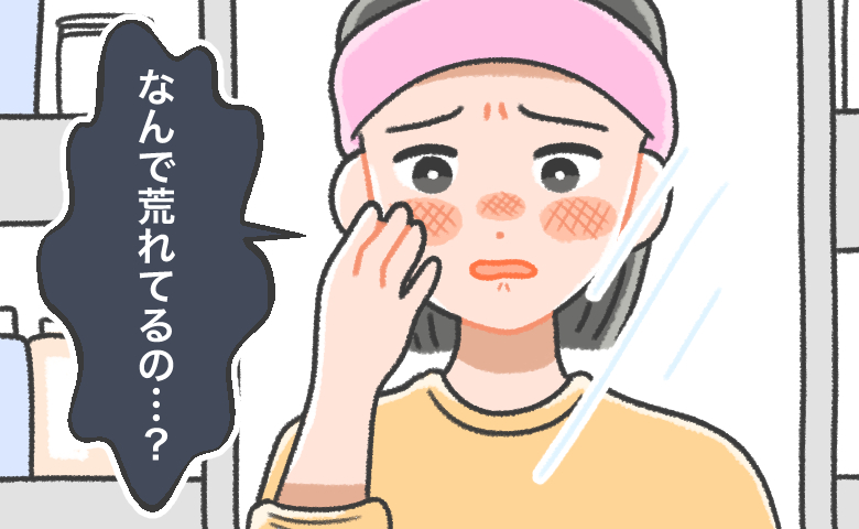 鏡に映った顔を見て、「なんで荒れてるの…？」と不安そうに頬を触っている中学生くらいの女性のイラスト
