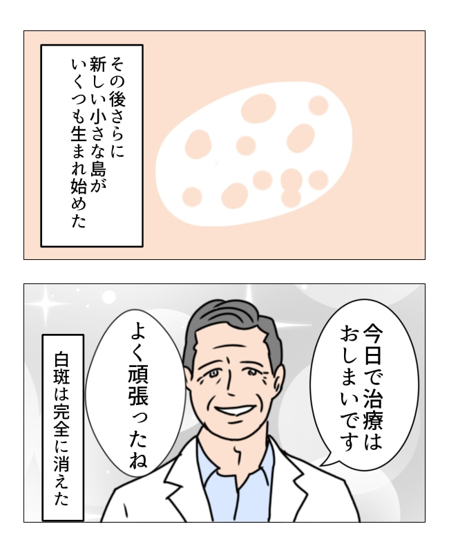 娘の尋常性白斑／フワリー